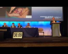 COMEG Symposium - Ultrasonic Rhinoplasty, Olivier Gerbault, MD