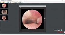 SOPRO Imaging 1