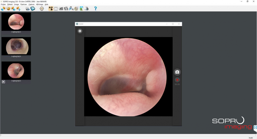 SOPRO Imaging 1