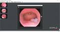 Sopro Imaging - GYN 1 