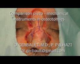 Comparison Piezo vs mechanical instruments-Dr Gerbault & Dr Palhazi